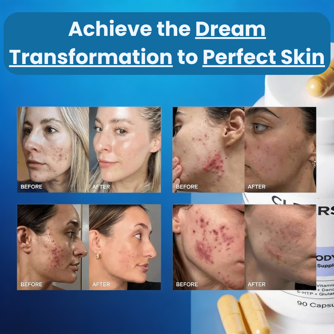 Celisse™ Hormonal Acne Supplement